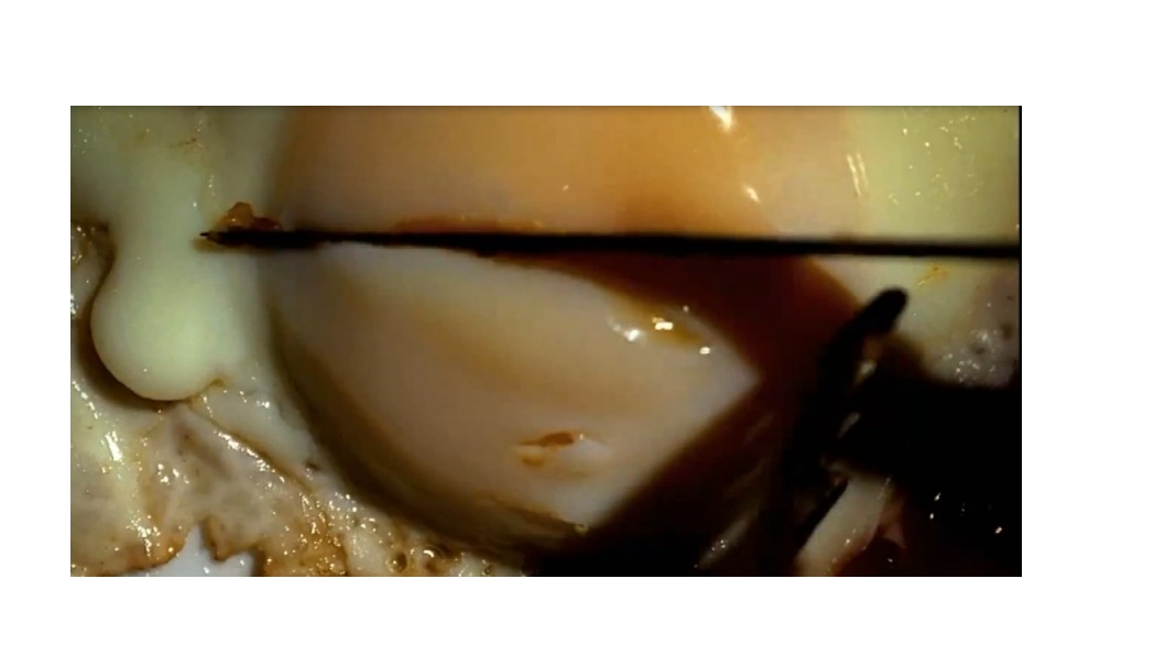 autopsie d'un générique - Dexter.